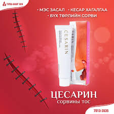 Цесарин 30гр сорвины тос Тэгш-Анар